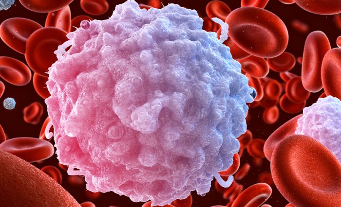 CIVIS Cups & Cakes, Sjogren's syndrome - STIRE